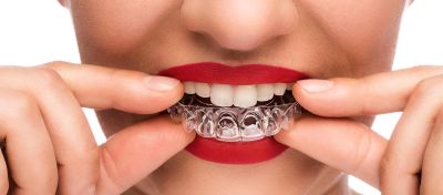 HP-Drucker ermöglichen den 3D-Druck von Zahnspangen für Nivellmedical