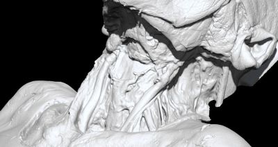 3D-Rendering eines Halssektionsschritts. Quelle: Artec 3D