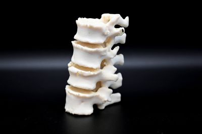 3D gedrucktes Original-Modell eines Teils der Wirbelsäule